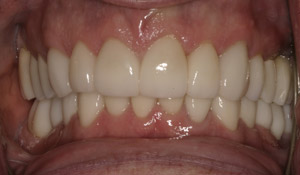 Case 1 after